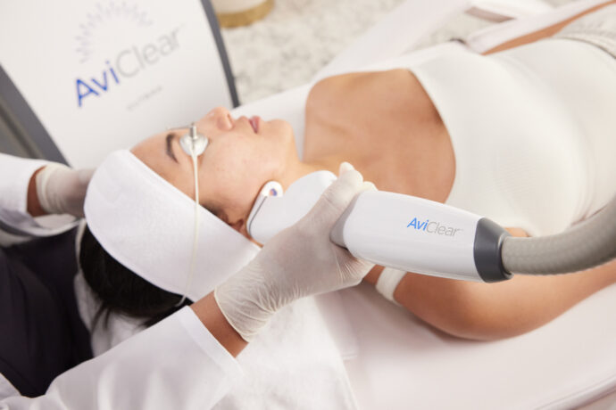 AviClear Aknebehandlung mit Laser